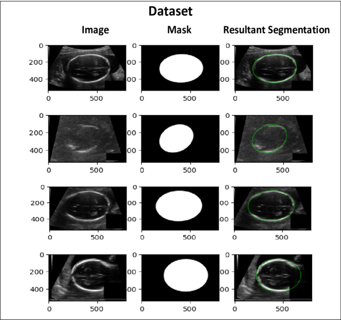 Dataset images and respective mask.