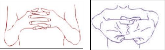 figure 22