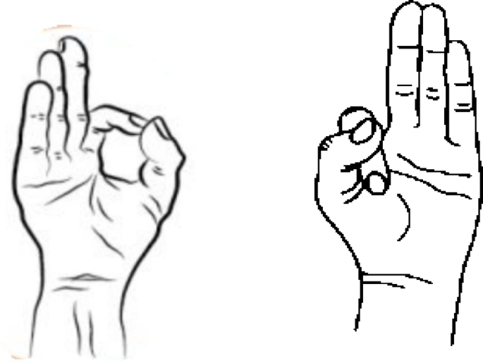 figure 31