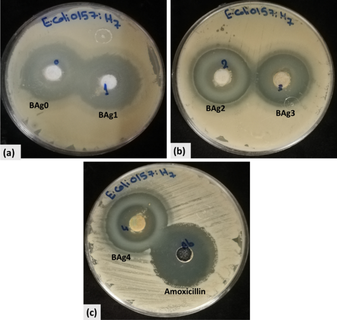 Removal of E. coli O157:H7 coliform bacteria from sewage wastewater using silver doped borate bioglass | Scientific Reports Removal of E. coli O157:H7 coliform bacteria from sewage wastewater using silver doped borate bioglass | Scientific Reports