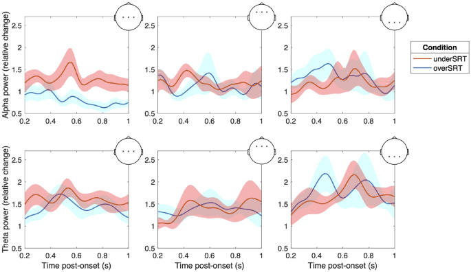 Dynamic assessment of listening effort by EEG alpha oscillations during ...