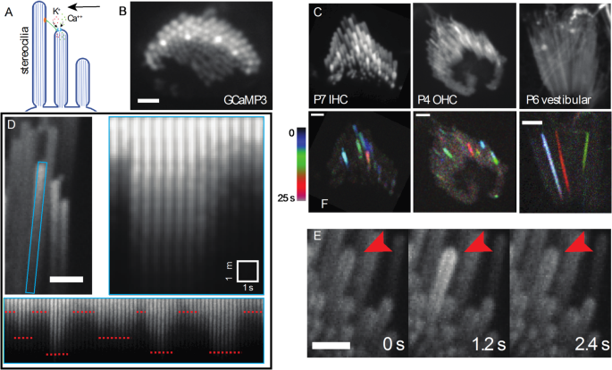 Spontaneous calcium transients in hair cell stereocilia | Scientific ...