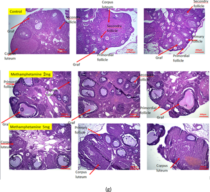 Prenatal methamphetamine exposure induces oxidative stress and apoptosis in  the ovaries of rat offspring | Scientific Reports