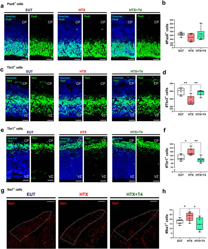 Fig. 4: Gestational HTX impairs embryonic cortical development and increases microglial pool
