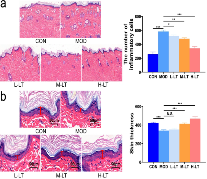L-Theanine mitigates skin aging in rats via modulation of the AGEs-RAGE  pathway, enhancement of antioxidant defense, and attenuation of  inflammation | Scientific Reports