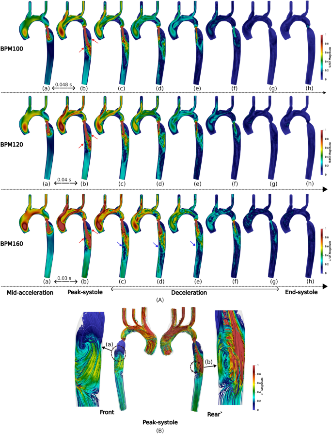 An in silico analysis of heart rate impact on wall shear stress ...