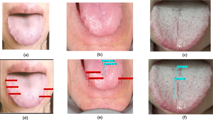 figure 15