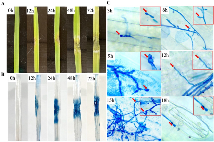 figure 11