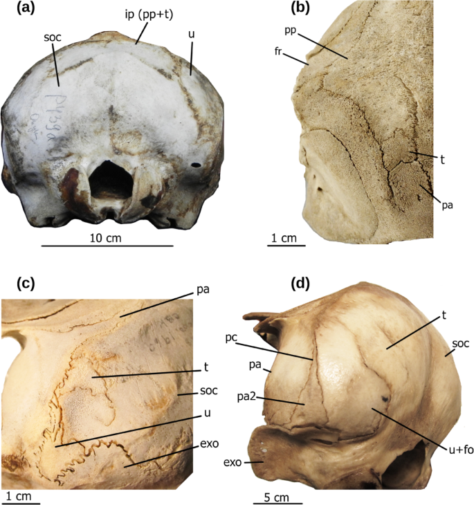 Evolution of accessory bones in cetacean skull coupled with decreasing ...