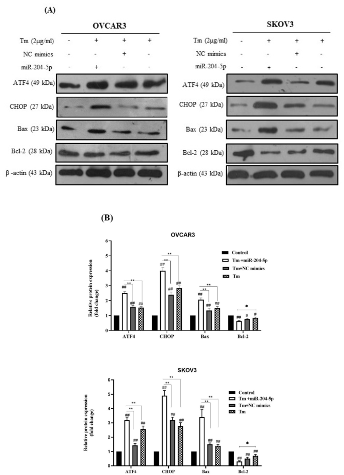 MiR-204-5p mediates PERK inhibition to suppress growth and induce ...