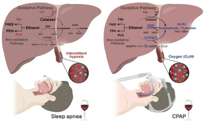 alcohol effect on sleep apnea diagram