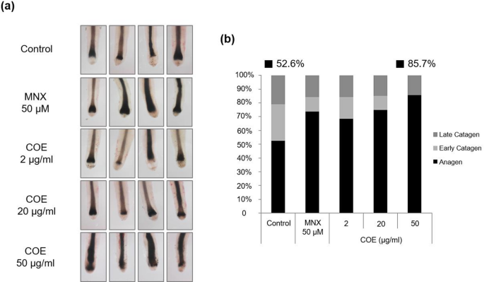 l-carnitine-l-tartrate promotes human hair growth in vitro Ferulic acid promotes hair growth via estrogen receptor alpha activation in  cultured human dermal papilla cells