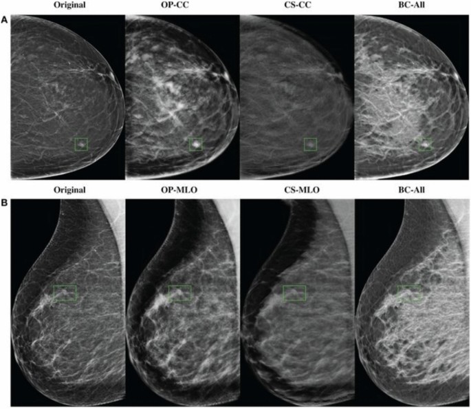 Fig. 4