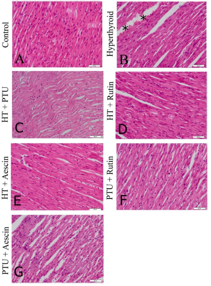 Aescin and rutin mitigate hyperthyroidism-induced multisystem dysfunction  via antioxidant and anti-inflammatory mechanisms in a rat model