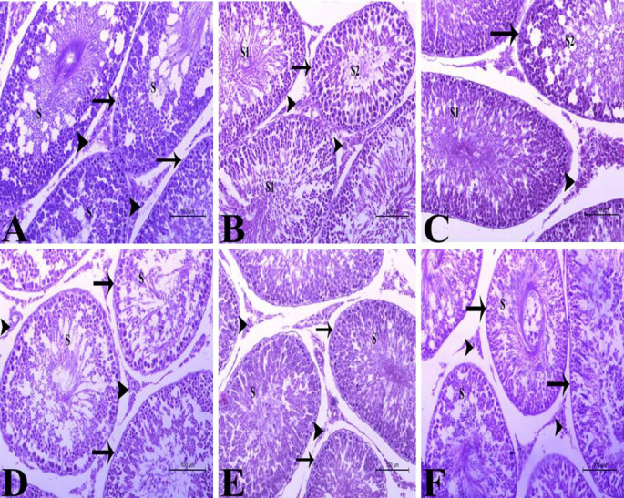 l-carnitine sperm morphology Niosomal l-carnitine and quercetin improve sperm quality and testicular  function in atrazine-induced reproductive toxicity in rats