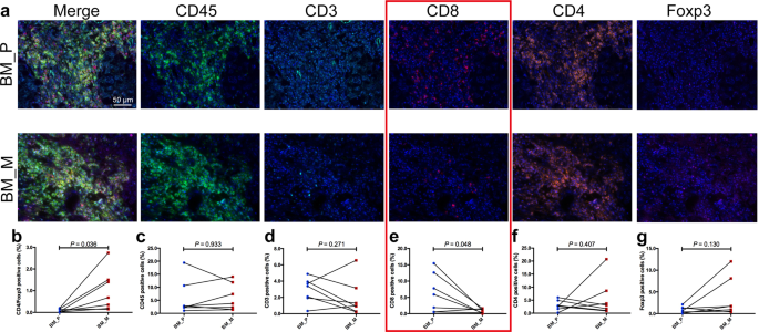 Fig. 5: Five immune related markers expression heterogeneity in tumor stroma of primary lesions and BM.