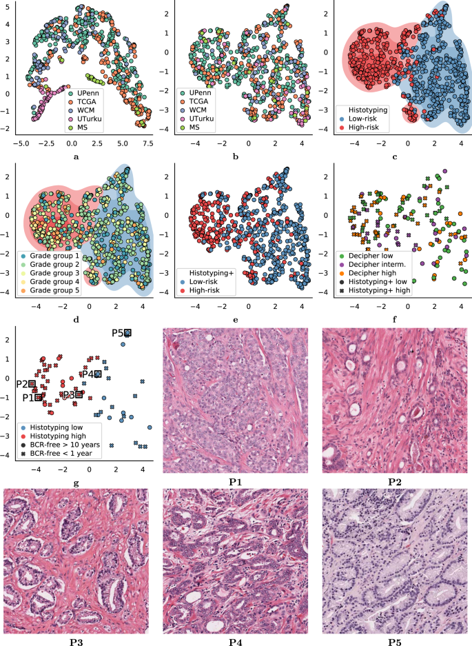 Fig. 1: UMAP embedding of image properties and Histotyping features.