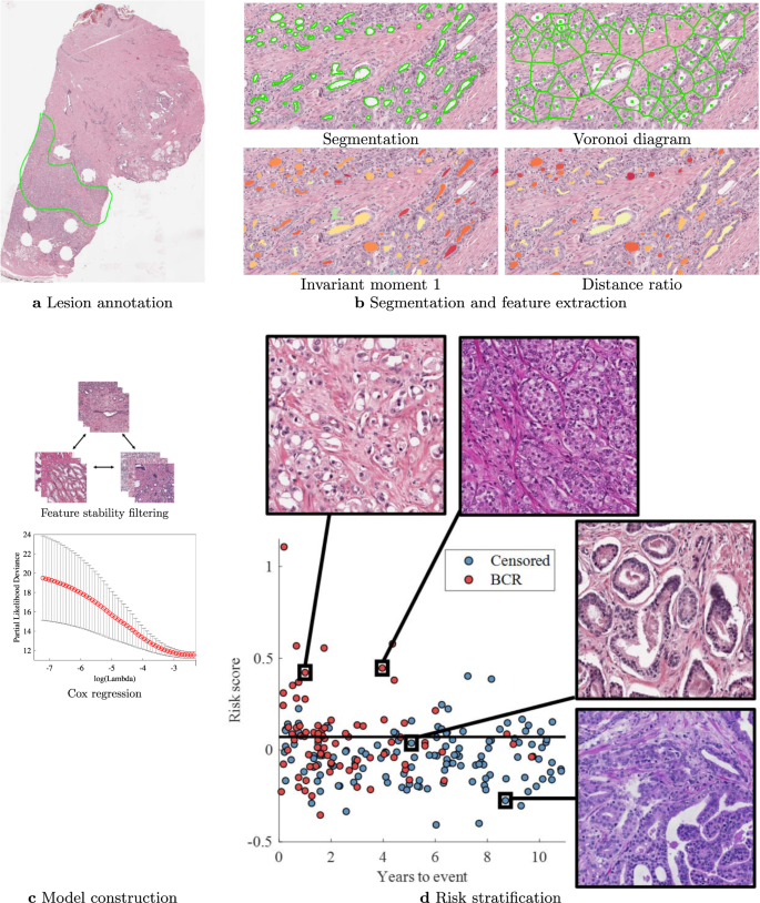 Fig. 7: Diagram of the Histotyping development process.