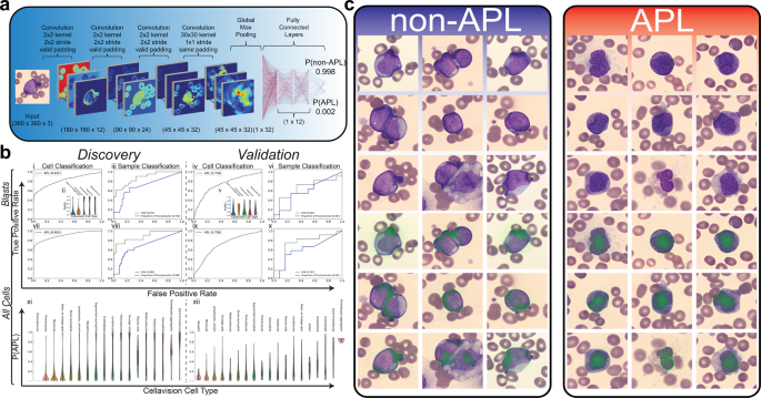 Fig. 1: Cell classification from peripheral smears.