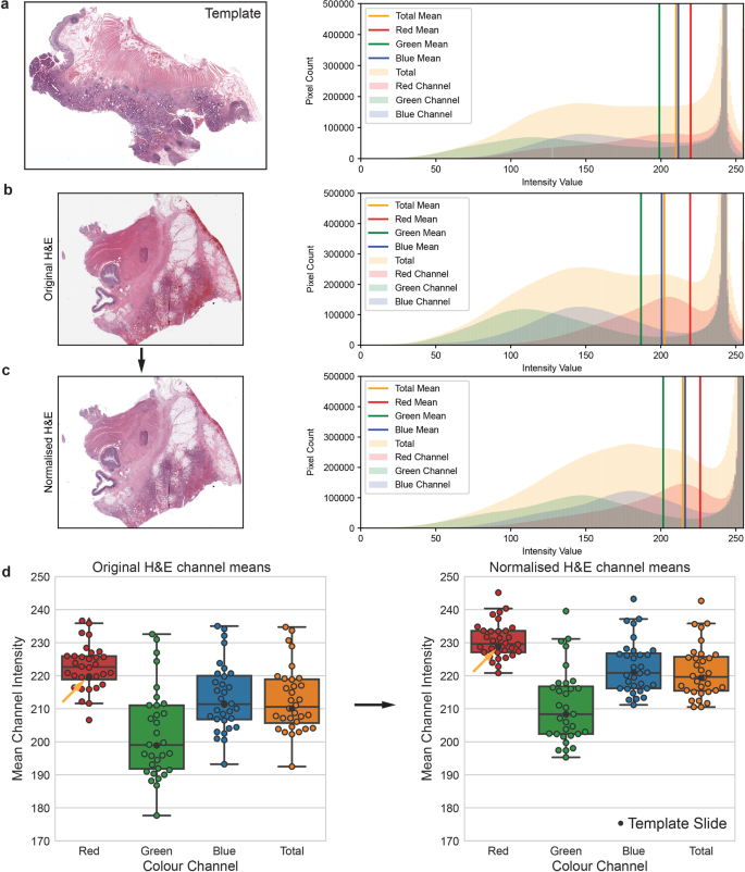 Fig. 2: H&E stain normalization.