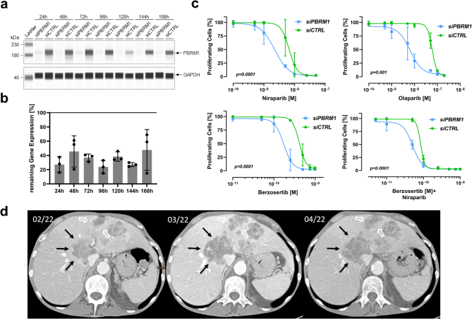 Fig. 3: Vulnerability of PBRM1 deficient biliary tract cancer to DNA damage repair targeting agents.