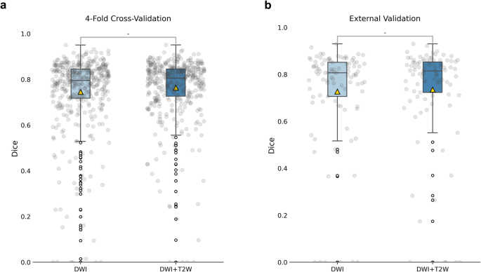 Fig. 2: The segmentation performance using nnUNet in the internal and external cohorts.