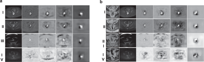 Fig. 4: Feature maps visualization.