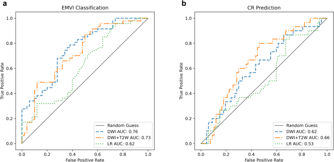 Fig. 5: The ROC Curves for EMVI classification and CR prediction in the external cohort (n = 97).