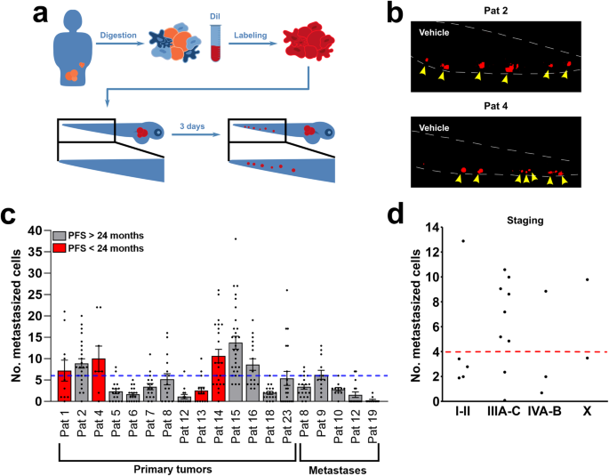 Fig. 4: Dissemination of tumour cells as a tool for prediction of outcome.