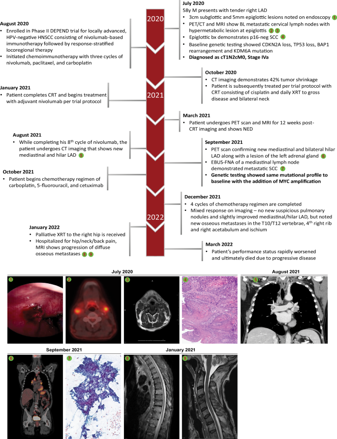 Fig. 1: Course of disease.