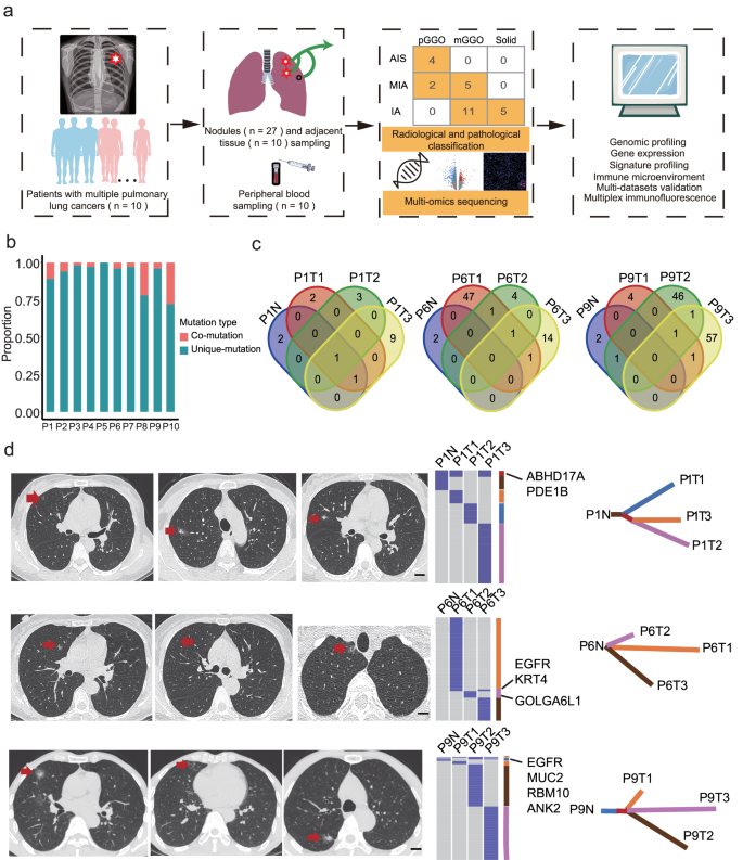 Fig. 1: Overview of the study and characteristics of pulmonary nodules.