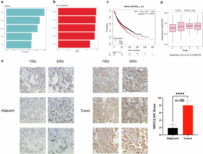 Fig. 5: XRCC2 as a potential biomarker in LUAD.