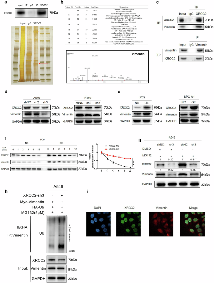 Fig. 6: VIM was a downstream interacting protein target of XRCC2.