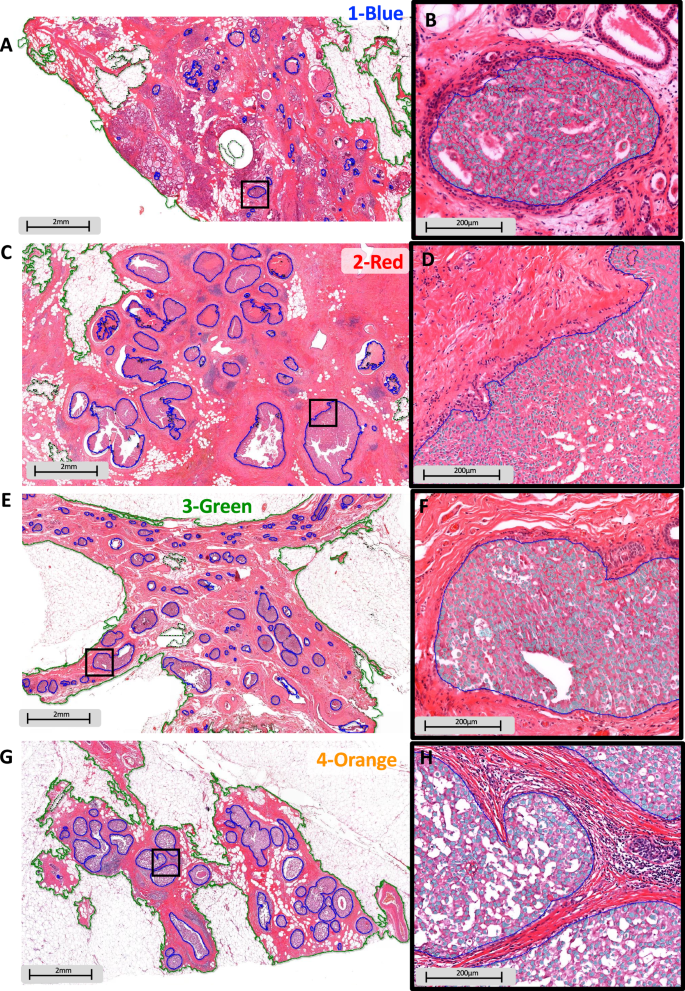 Fig. 5: Comparative morphology between the AIDmap signatures.