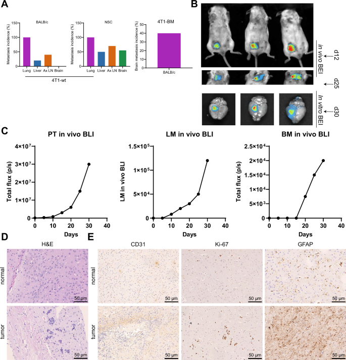 Role of GPX3+ astrocytes in breast cancer brain metastasis activated by circulating tumor cell exosomes