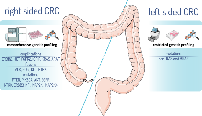 Fig. 4: Potential future recommendations for molecular testing in MSS-mCRC stratified by tumor location.