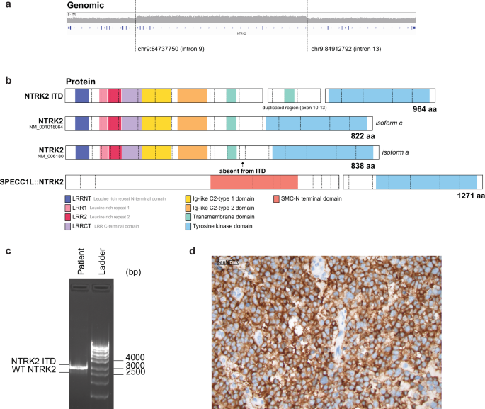Fig. 1: WGS identifies a novel NTRK2 ITD resulting in a duplication of the transmembrane domain.