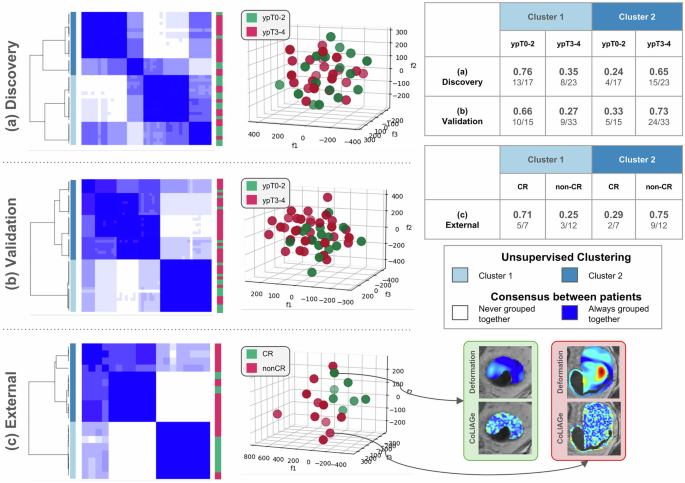 Fig. 2: Consensus clustering heatmaps and scatter plots via t-SNE projection of StODeO + texture radiomic descriptors.