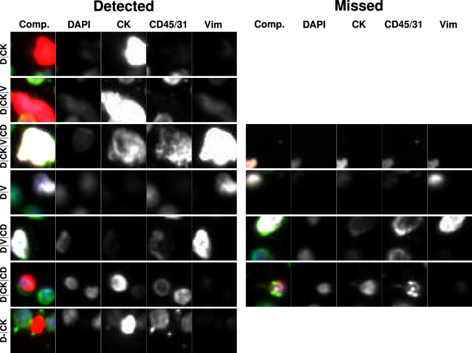 Fig. 6: Representative gallery of rare events in samples collected from patients diagnosed with late-stage breast cancer.