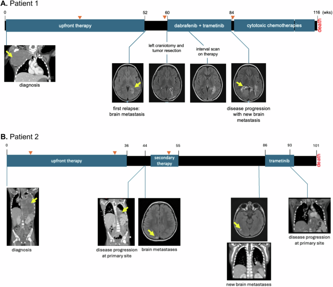 Fig. 1: Timeline of the clinical course for each patient.