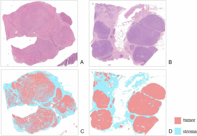 Fig. 2: Representative segmentation performance examples.