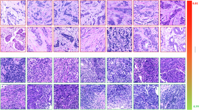 Fig. 3: Histological characteristics varied between patches of high and low TR-scores.