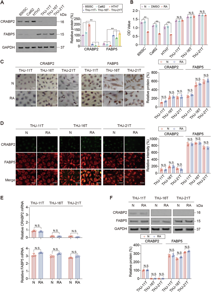 Fig. 1: CRABP2 and FABP5 expression patterns in the ATC cell lines with and without RA treatment.
