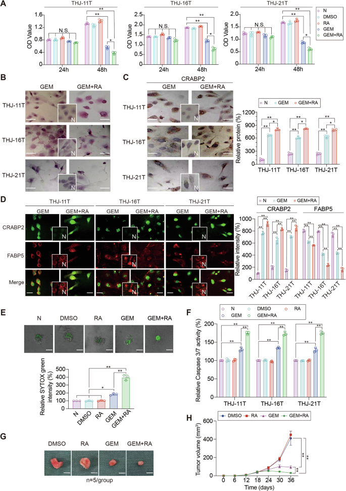 Fig. 2: Effects of gemcitabine and its combination with RA on the growth of ATC cells.