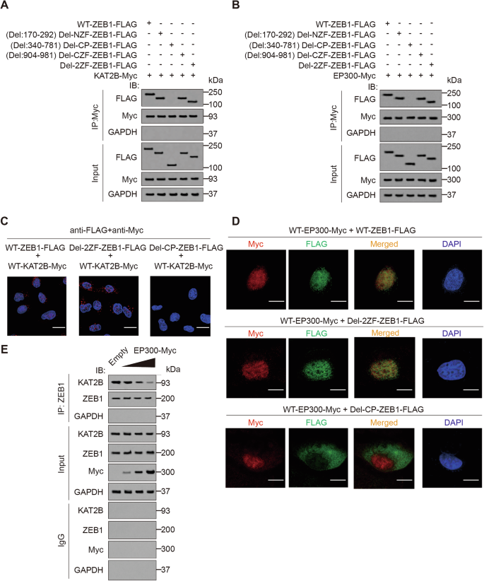 Fig. 4: ZEB1 directly interacts with KAT2B and EP300 in a ZF-CP-dependent pattern.