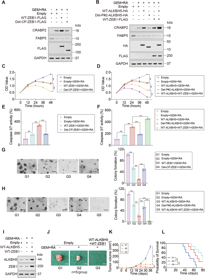 Fig. 7: Combined overexpression of ZEB1 and ALKBH5 can enhance the therapeutic effects of GEM and RA.