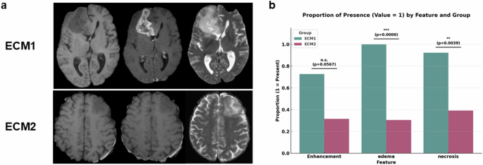 Fig. 5: Radiological differences between ECM subtypes.