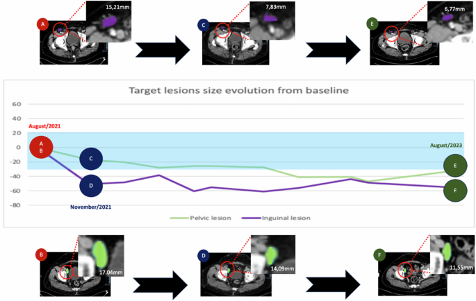 Fig. 1: Course of disease.