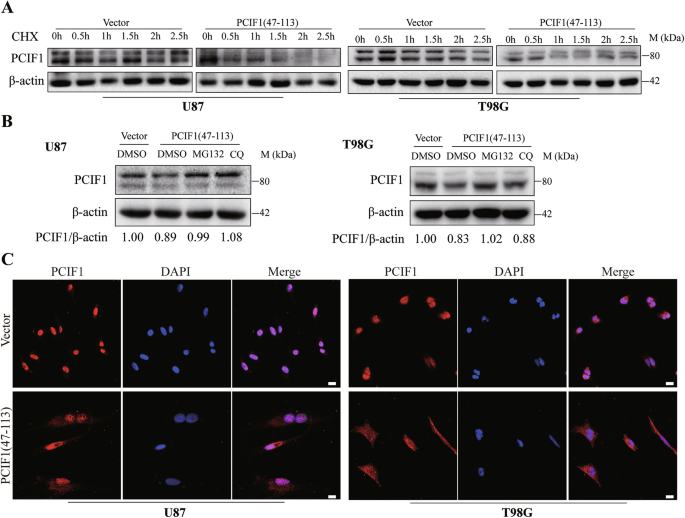 Fig. 6: Overexpression of the WW domain promotes the degradation of endogenous PCIF1 protein and facilitates its translocation from the nucleus to the cytoplasm.