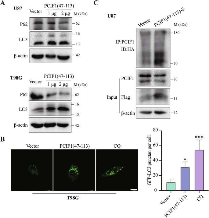 Fig. 7: Overexpression of the WW domain of PCIF1 induces autophagy and promotes the ubiquitination of PCIF1 in glioma cells.